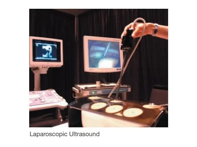 Abdominal Intraoperative and Laparoscopic Ultrasound - IOUSFAN