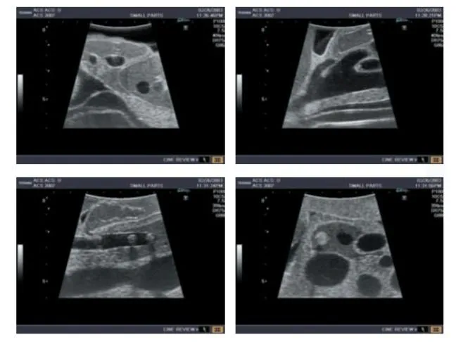 Abdominal Intraoperative and Laparoscopic Ultrasound - IOUSFAN