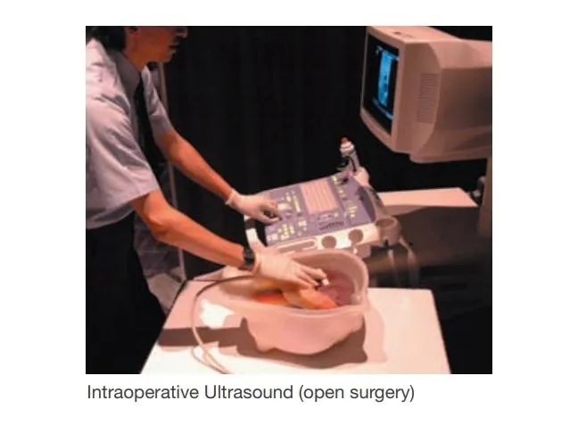 Abdominal Intraoperative and Laparoscopic Ultrasound - IOUSFAN